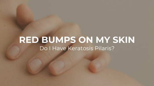 Red Bumps On My Skin - Do I Have Keratosis Pilaris?